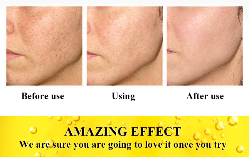 Breylee Face Repair Cream Vitamin C 20% - 40g - Discount Applied